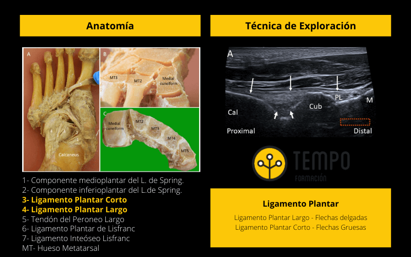 Ligamento Plantar.png